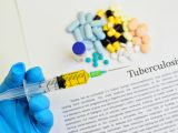 Tubercolosi