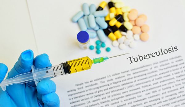 Tubercolosi